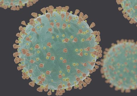 Computer generated representation of COVID-19 virions under electron microscope